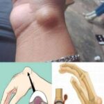 If you hear ringing in your ear, this is a sign that you will suffer from…see more