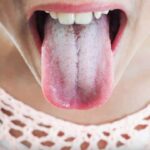 Did you know that if your ear hairs grow, it is because your body is… See more