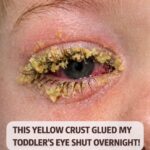 You’ll Never Need Makeup to Hide Dark Spots and Pigmentation ~ Apply This on Your Face for Spotless & Glowing Skin