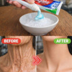 If you have lines on your nails, it means you have ca…See more