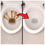Hidden Parasites in the Body: The Silent Invaders 🦠😱