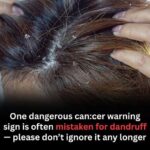 Ear Hair and Your Health: What Doctors Say About This Overlooked Body Sign 👂✨