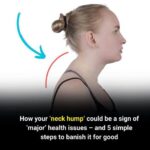 If You Notice a Rotten Fish Smell, Here’s What Your Body Might Be Telling You…