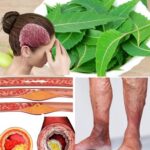 : Are Purple Spots Appearing on Your Skin? Here’s Why This Deserves Attention