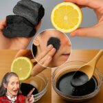 7 Foods That Kill Intestinal Worms Naturally 🌿💪…