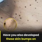 Vaginal Discharge Explained: What’s Normal, What’s Not,