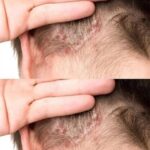 10 Warning Signs Your Body Could Be Showing About Cancer — Don’t Ignore These…