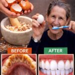 Say Goodbye to Shaving: A Natural Approach