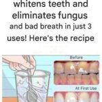 🔥 This Natural Remedy Helps Fight Nail Fungus…