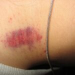 Psychologist Reveals What It Means If You Dreamed That You Slept With Your Ex…